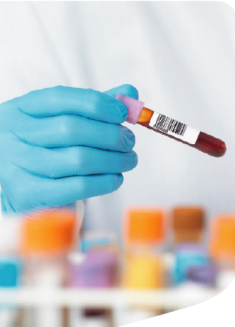 Kontrola jakości i identyfikacji próbek DNA 15 Kontrola jakości i identyfikacji próbek DNA Kontrola jakosci i identyfikacji probek DNA Kontrola jakości i identyfikacji próbek DNA Kontrola jakości i identyfikacji próbek DNA